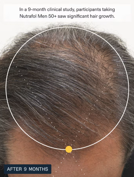 NUTRAFOL- Hair Growth Pack for Men 50+