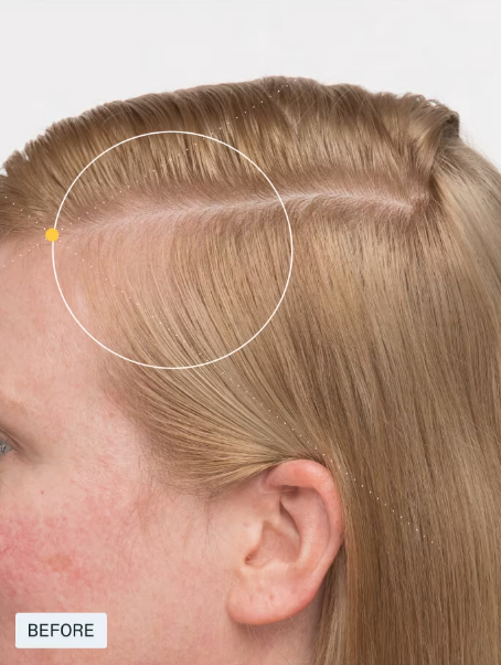 NUTRAFOL-Women's Balance Hair Growth Pack